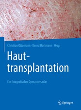Hauttransplantation - Ein fotografischer Operationsatlas